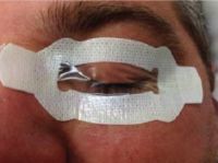 eyepro anel augenschutz anästhesie